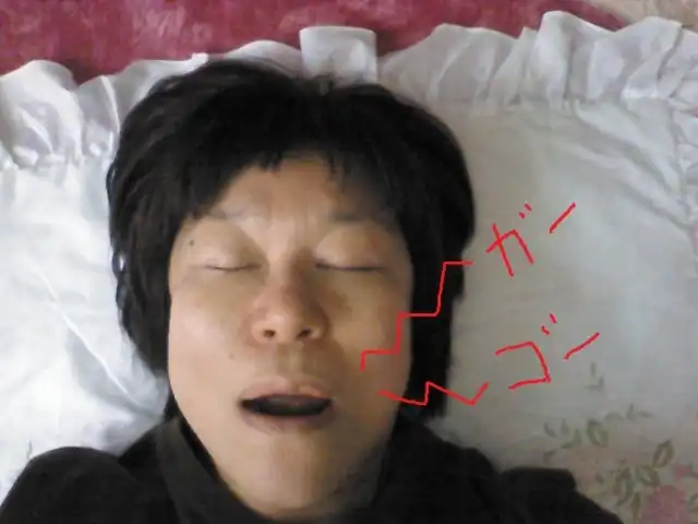 【女性にも多くの未治療患者!】睡眠時無呼吸症候群の症状を見逃すな!いびき・日中の眠気から重大な合併症まで徹底解説